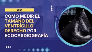 🚀Cómo Medir el 🔥TAMAÑO DEL VENTRÍCULO DERECHO por Ecocardiografía Guía Completa [upl. by Peggie622]