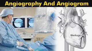 What is Angiography and Angiogram  How Angiography is performed 3D Animation [upl. by Uzial]