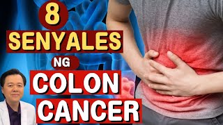 8 Senyales ng Colon Cancer  Payo ni Doc Willie Ong Internist and Cardiologist [upl. by Cinelli]