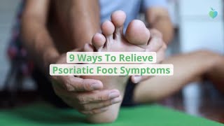 9 Ways To Relieve Psoriatic Foot Symptoms [upl. by Esteban365]