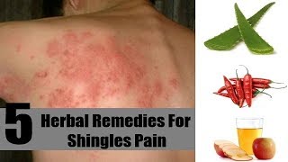 5 Home Remedies for Shingles Nerve Pain  By Top 5 [upl. by Eniledgam961]