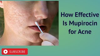 How Effective Is Mupirocin for Acne [upl. by Oringas]