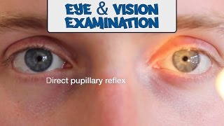 Examination of the Eyes and Vision  OSCE Guide old version  UKMLA  CPSA [upl. by Enuj]