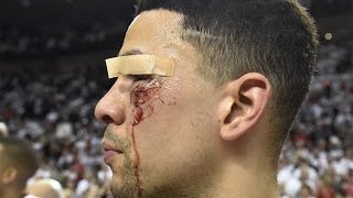 Top 5 Worst Sports Injuries of 2016 [upl. by Atterys]