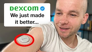 Dexcom G7 Major Upgrades Revealed – Don’t Miss Out [upl. by Elleniad]