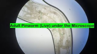 Adult Pinworm Microscopy [upl. by Elka]