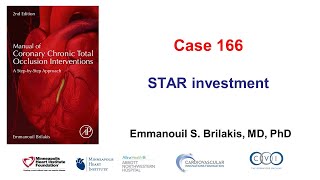 Case 166 Manual of CTO PCI  STAR investment [upl. by Ennaeel]