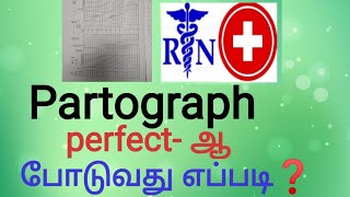 Partograph and its importanceHow to put perfect partograph in tamil [upl. by Nnylorac]