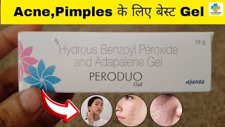 Peroduo Gel Use in Hindi  Benzoyl peroxide amp Adapalene Gel Use  Acne  pimples  SK MEDICINE [upl. by Lunna]