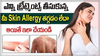 Best Treatment for Skin Allergy  Skin Care Tips  Skin Allergy in Telugu  One Hospitals [upl. by Ezana]