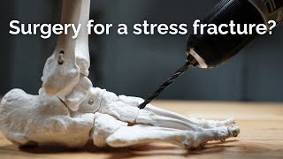 Stress Fracture Surgery What You Need to Know [upl. by Ydeh429]