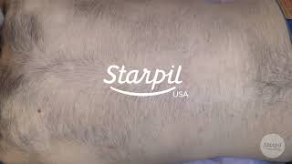 How to Wax Mens Back Hair  Full Back Hair Removal  Starpil Wax [upl. by Mulloy771]