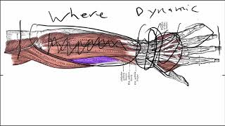 Wrist Tendonitis Symptoms Basics  The Actual Causes [upl. by Ayala]