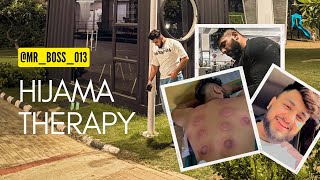 HIJAMA THERAPYMUSCLES RECOVERY💪TRICEP WORKOUT [upl. by Eixor]