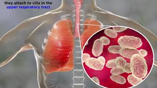 Whooping Cough Bordetella pertussis [upl. by Ynehteb]