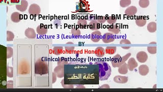 Part1  Peripheral Blood Film Lecture 3 Leukemoid blood picture [upl. by Poore777]