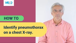 How to identify pneumothorax on a chest Xray [upl. by Horatius]