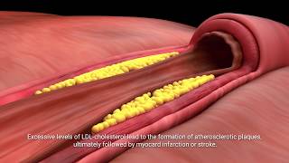 Lactobacillus plantarum INDUCIA [upl. by Conias]