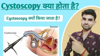 Cystoscopy in Hindi  Cystoscopy meaning  Purpose and Complications of Cystoscopy [upl. by Arette922]