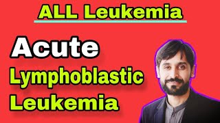 Acute Lymphoblastic Leukemia  ALL Leukemia  MLT Hub with kamran [upl. by Moule]