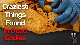 5 Craziest Things Ive Found In Dead Bodies [upl. by Benioff]