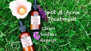 DIY Spot amp Acne Treatment [upl. by Radman587]