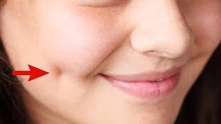 How To Get Dimples Fast And Naturally Beauty Tips [upl. by Belia]