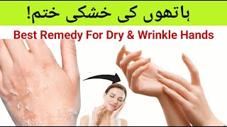 Best Remedy For Dry amp Wrinkle Hands In UrduHindi [upl. by Cirdahc81]