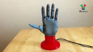 Open Bionics ADA Hand by Team UnLimbited [upl. by Gaivn]