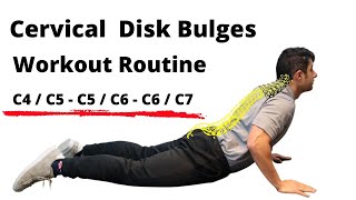 Workout routine for Cervical Disc Bulges  Beginner Level [upl. by Aleak]