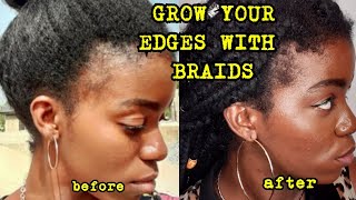 HOW I GREW MY EDGES BACK 2020 WITH BRAIDS NATURAL HAIR EDGES 4C NATURAL HAIR HAIR GROWTH TIPS [upl. by Adnoyek]