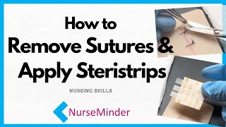 How to Remove Sutures and Apply Steristrips Nursing Skills [upl. by Dorisa749]