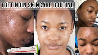 HOW TO GET RID OF ACNE amp ACNE SCARS  TRETINOIN SKINCARE ROUTINE ♡ OfficialTashika [upl. by Latisha]