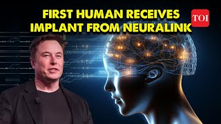 Watch Brain Chip in first Human implanted by Elon Musks Neuralink  Approved by FDA for Trials [upl. by Rhody]