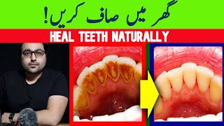 Dr ZeeNatural Remedy for dental Plaque Cavities and Gingivitis [upl. by Minna780]