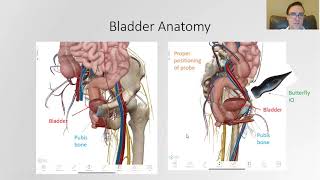 How to Complete a Bladder Scan with the Butterfly iQ [upl. by Kirat]