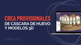 ¡Crea Provisionales de Cáscara de Huevo y Modelos 3D adaptados a tu diseño como un PRO EXOCAD [upl. by Ronalda158]