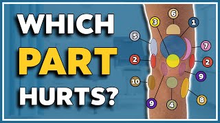 My knee hurts here 10 typical pain spots and what they mean [upl. by Leinnad]