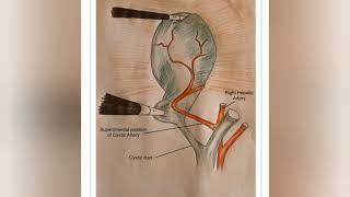 normal variability in the position of cystic artery [upl. by Ardnasyl114]