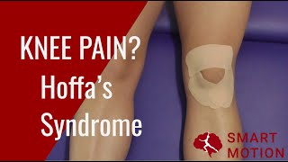 ANTERIOR KNEE PAIN Use this TAPE What to do if you have Hoffas fat pad syndrome [upl. by Nalym]