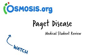 Paget Disease of Bone Osteitis Deformans  with a Mnemonic [upl. by Schaeffer]