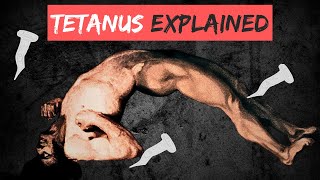 TETANUS explained in 10 Minutes [upl. by Yevreh870]