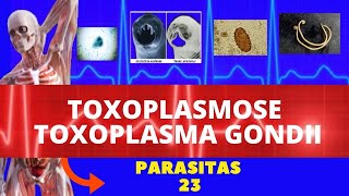 TOXOPLASMOSE TOXOPLASMA GONDII  PARASITOLOGIA  INFECTOLOGIA [upl. by Eudoca]