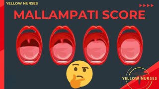 Mallampati classification score to identify difficult airway [upl. by Nallij]