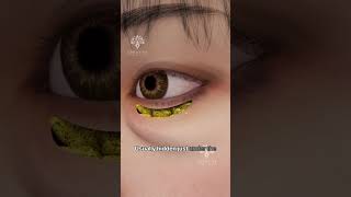 How Does Puffy Eye Surgery Work shorts viralvideo  Creativelearning3d [upl. by Anivas847]