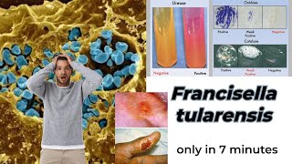 Francisella microbiology lecture  Francisella tularensis Easy Microbiology [upl. by Nahgeem]