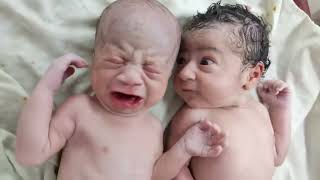 Twins after birth where one is fed up with other one cry  Just Stop It 😂 [upl. by Anitnemelc]