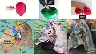 Azygos Vein amp Fissure on Radiology Xray CT amp MRI [upl. by Aedrahs]