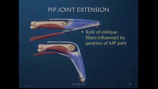 Obstinate PIP Joint Part 3 of 12 Drivers of PIP Joint Extension [upl. by Ateuqahs]