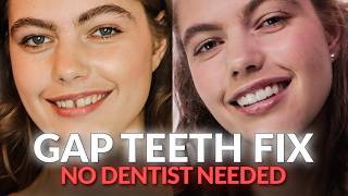 Stop Gap Teeth Embarrassment Transform Your Smile NOW [upl. by Triplett70]